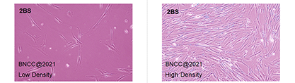 Human embryonic lung diploid cells-BNCC