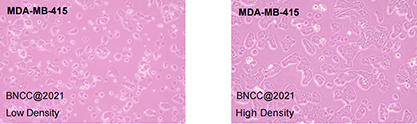 Human breast cancer cells-BNCC