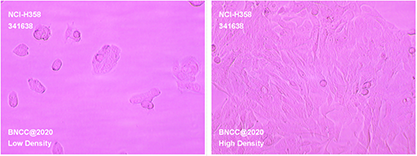 Human non-small cell lung cancer cells-BNCC