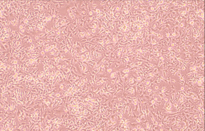 Chicken liver cancer cells-BNCC