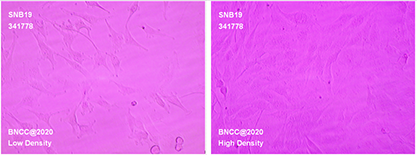 Human glioblastoma cells-BNCC