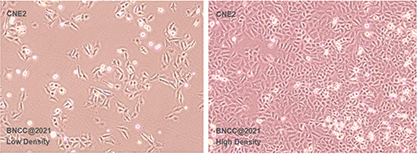 Human nasopharyngeal carcinoma cells (recognized as contaminated by HELA)-BNCC