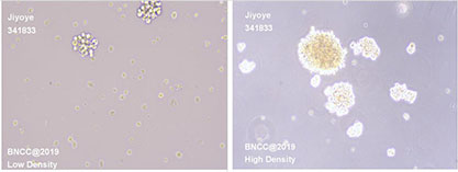 Human B lymphocyte-BNCC