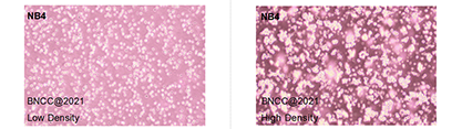 Human acute promyelocytic leukemia cells-BNCC