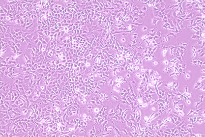 Mouse myeloid breast cancer cells-BNCC