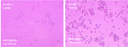 Human skin melanoma cells-BNCC