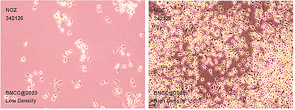 Human gallbladder cancer cells-BNCC