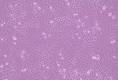 Human cervical cancer cells-BNCC