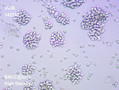 Human multiple myeloma cells-BNCC