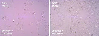 Human rhabdomyosarcoma cells-BNCC
