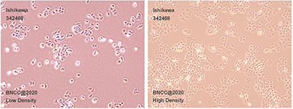 Human endometrial carcinoma cells-BNCC
