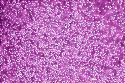 Mouse liver cancer cells-BNCC