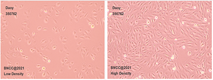 Human medulloblastoma cells-BNCC