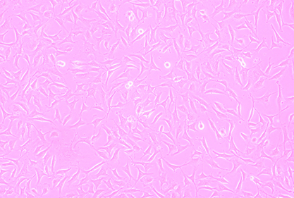 Human umbilical vein cell fusion cell-BNCC