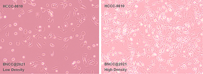 Human bile duct cell type liver cancer cells-BNCC