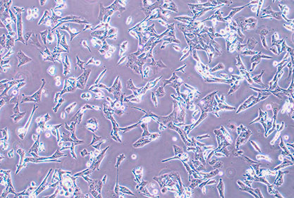 Human osteosarcoma cells-BNCC