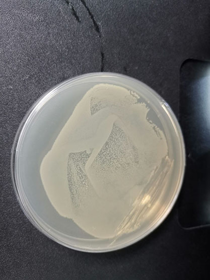 Escherichia coli-BNCC
