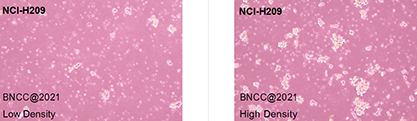 Human small cell lung cancer cells-BNCC