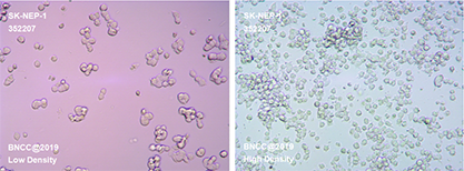 Human nephroblastoma cell-BNCC