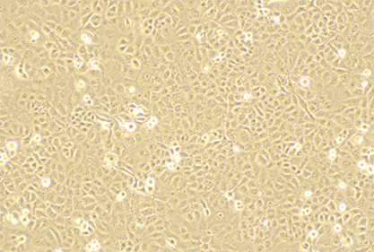 Human pancreatic cancer cells-BNCC