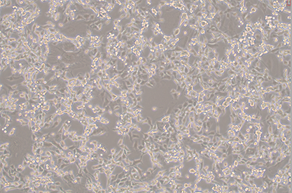Mouse colon cancer cells-BNCC