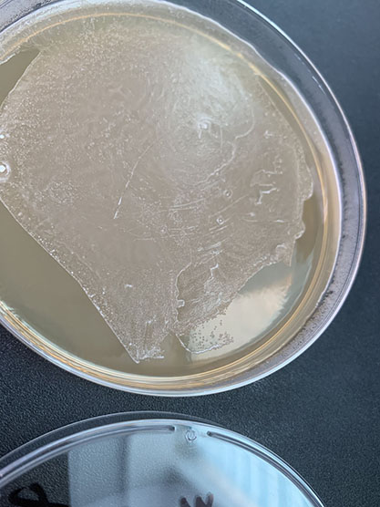 Lactobacillus plantarum-BNCC