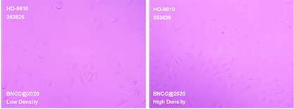 Human ovarian cancer cells (recognized as contaminated by HELA)-BNCC
