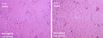 Human pancreatic ductal adenocarcinoma cells-BNCC