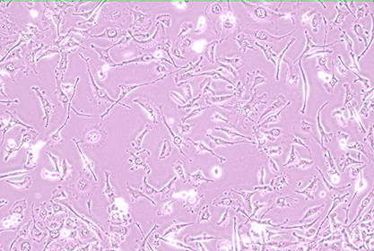 Human mammary duct cancer cells-BNCC