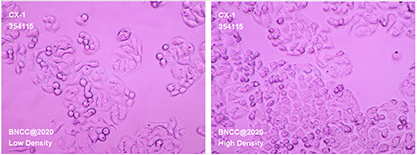human colorectal cancer cells-BNCC