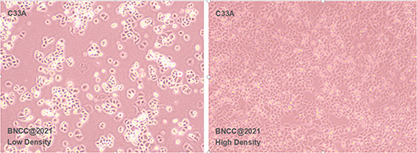 Human cervical cancer cells-BNCC