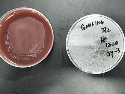 Bacteroides thetaiotaomicron-BNCC