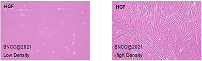 Human cardiac fibroblasts-BNCC