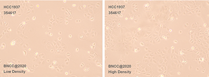 Human breast cancer cells-BNCC