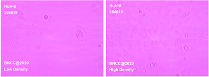 Human hepatoblastoma cells-BNCC