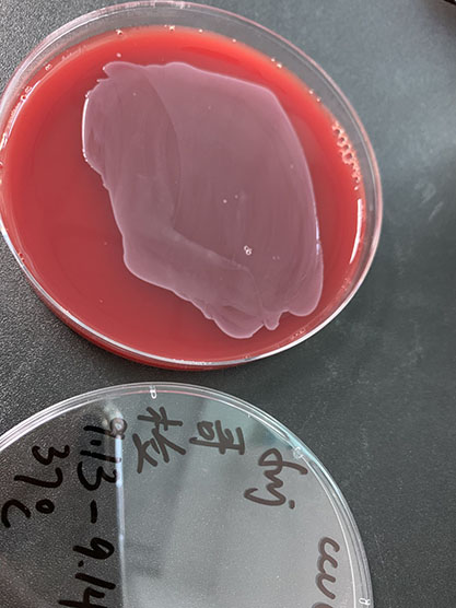 Listeria monocytogenes-BNCC