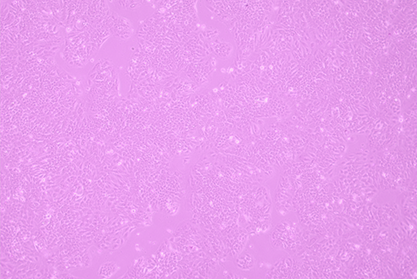 Human nasal mucosal epithelial cells-BNCC