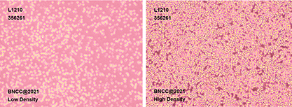 Mouse leukemia cells-BNCC