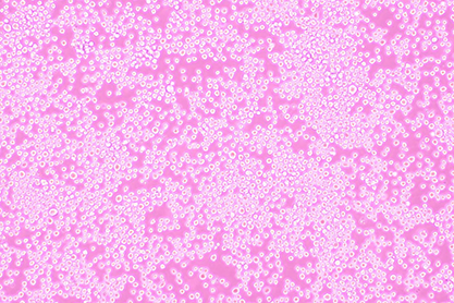 Mouse lymphoma cells-BNCC