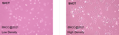 Human mammary epithelial cells-BNCC