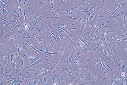 Human gingival fibroblasts-BNCC