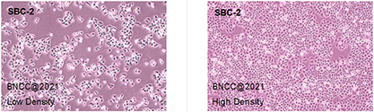 Human bladder cancer cells (contaminated with hela)-BNCC