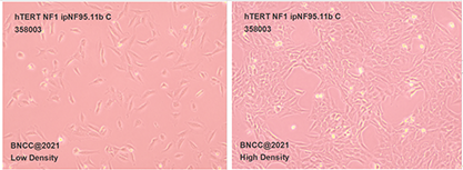 Human plexiform neurofibroma cell Schwann cell-BNCC