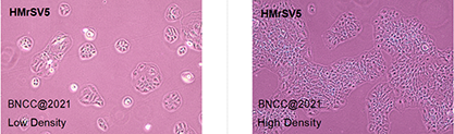 Human peritoneal mesothelial cells-BNCC