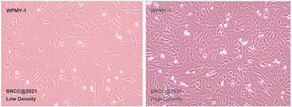 Immortalized cells of human normal prostate stroma-BNCC