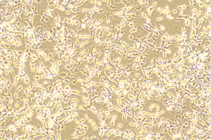 Mouse islet tumor cells-BNCC