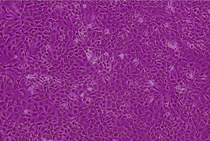 Human bladder transitional cell cancer cells-BNCC