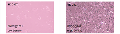 Human non-small cell lung cancer cells-BNCC
