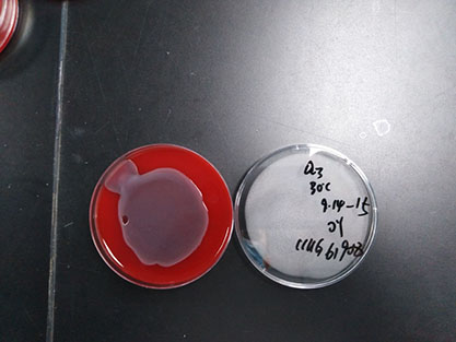 Escherichia coli-BNCC