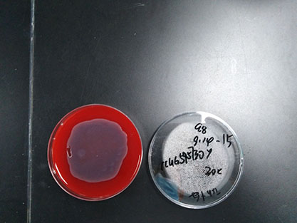 Enterobacter roggenkampii-BNCC